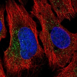 NHE6/SLC9A6 Antibody, Novus Biologicals 25 &mu;L, Unlabeled:Antibodies,